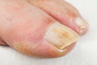 Angel Chiropody and Podiatry 697026 Image 2